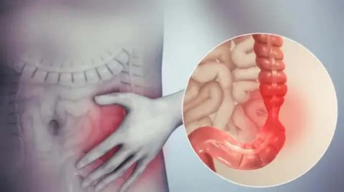 من غير فرن| طريقة عمل كيكة الشيكولاتة وزبدة